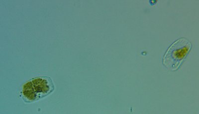 Dinoflagellaten1.jpg