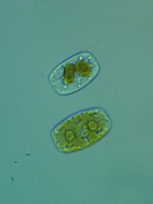 Dinoflagellaten2.jpg